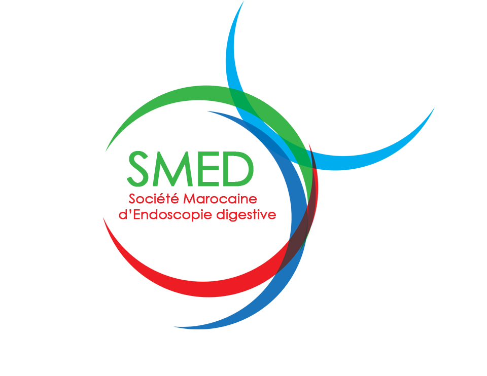 SMED